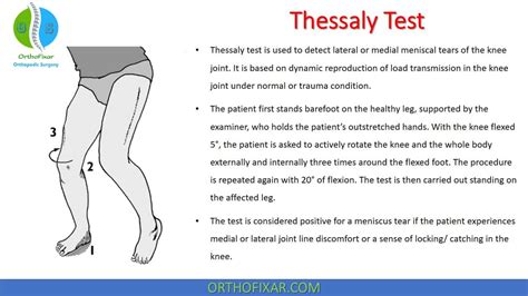 test for knee meniscus tear|standing test for meniscus tear.